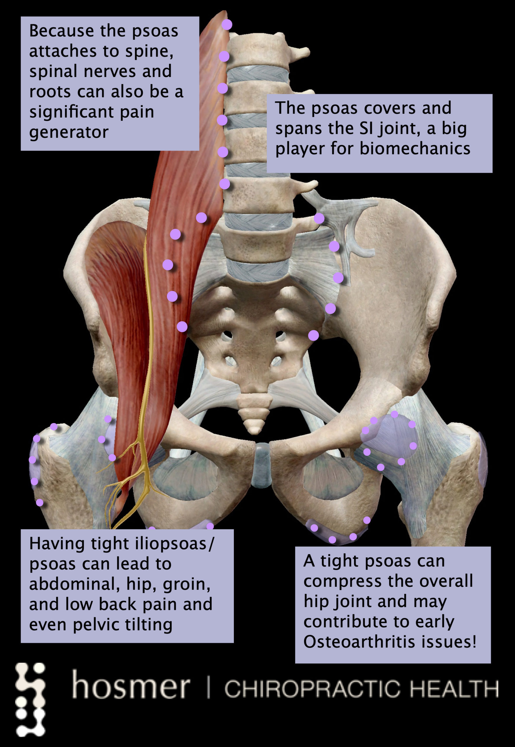 Hosmer Chiropractic Presenting: the Hosmer Highlight of the Month ...